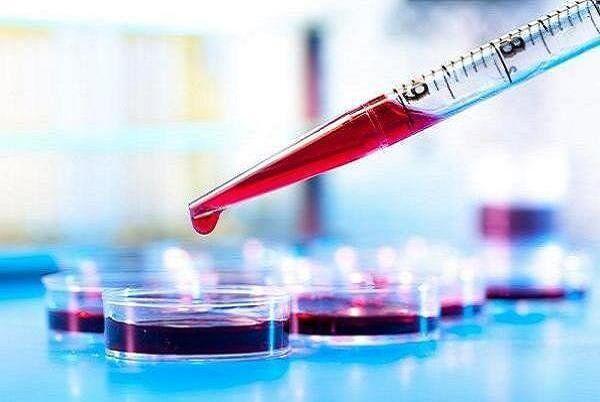 خون پیر؛ عامل تسریع پیشرفت آلزایمر؛ ترکیبات خون جوان محافظت می‌کنند