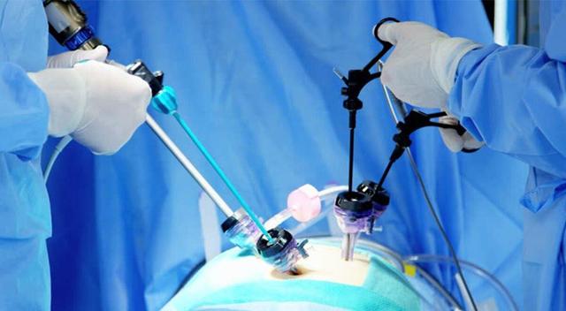 نخستین عمل جراحی پیشرفته آپاندیس در سنندج انجام شد