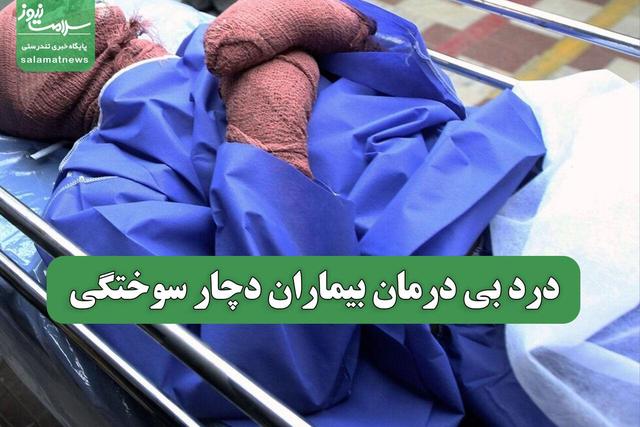 درد بی درمان بیماران دچار سوختگی