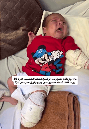 نوزاد ۴۰ روزه شاهدی کوچک بر فاجعه‌ای بزرگ