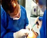 اجرای طرح وارنیش فلوراید تراپی در بین دانش آموزان خراسان شمالی 