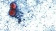 First two US deaths linked to diarrhea-inducing parasite confirmed