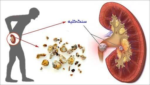 چه داروهایی برای کلیه پر خطر هستند؟