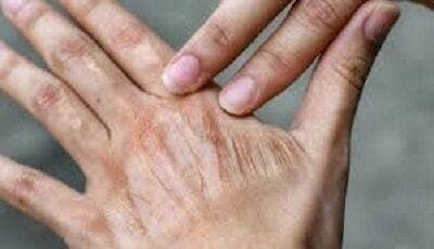 اشتباه‌های رایج در مراقبت روزانه از پوست