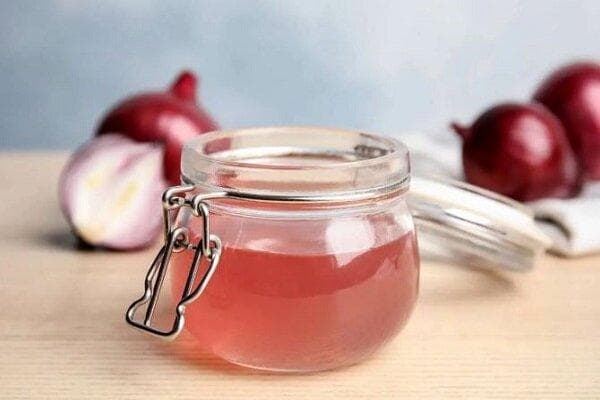 ۵ فایده آب پیاز برای داشتن موهای سالم
