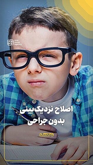 اصلاح نزدیک‌بینی بدون جراحی