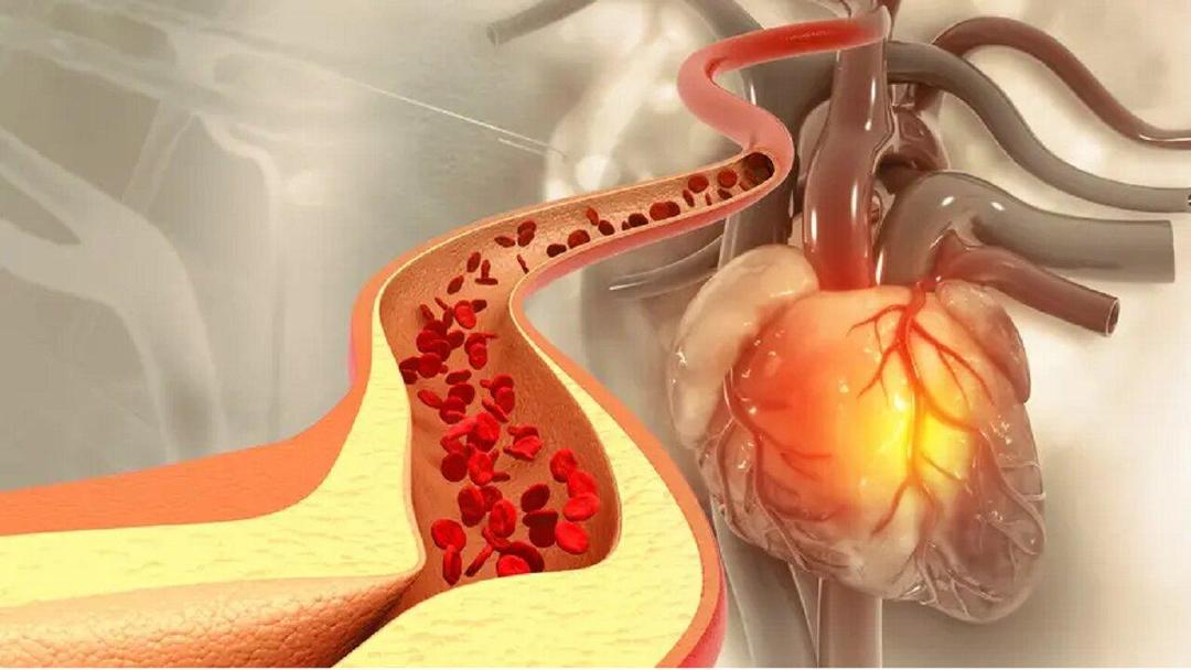 یک روش ساده برای کاهش کلسترول خون