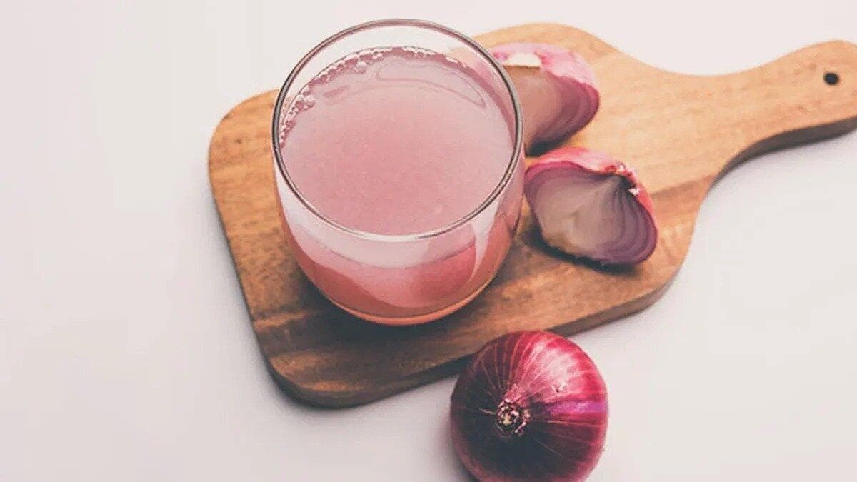 چگونه با آب پیاز موهای سالم‌تری داشته باشیم؟ | روش تهیه و نحوه استفاده برای رشد مو