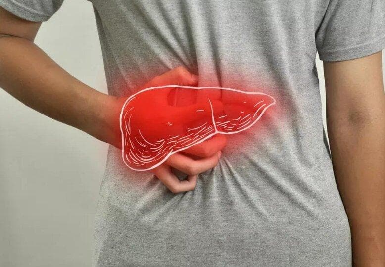 ۳ گام اشتباه در مسیر سیروز کبدی | چه کنیم کبد چرب نگیریم؟