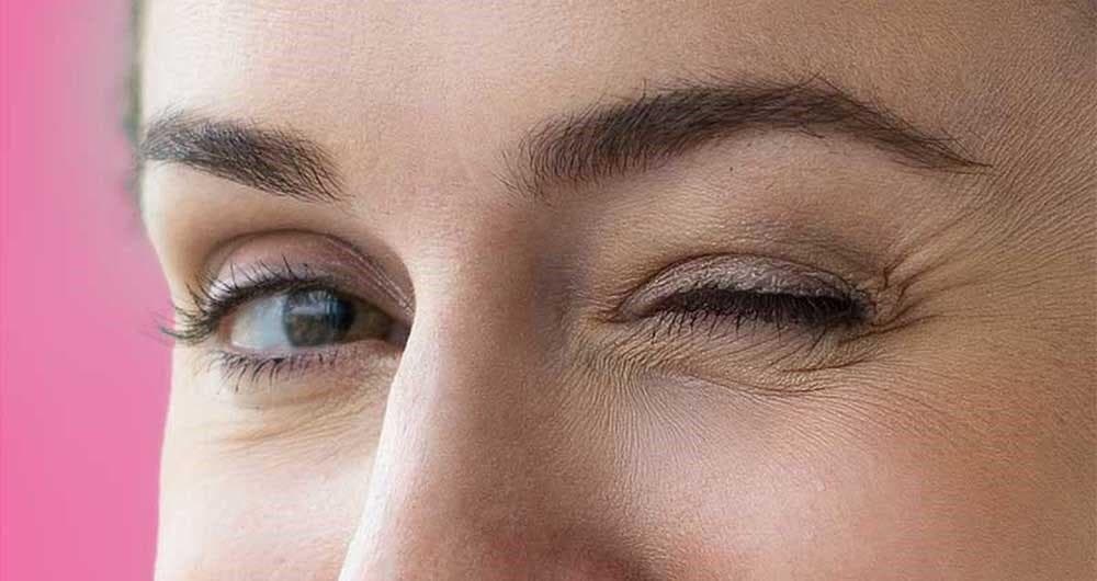 پرش پلک یا تیک عصبی چشم؛ علت، علائم و روش‌های درمان