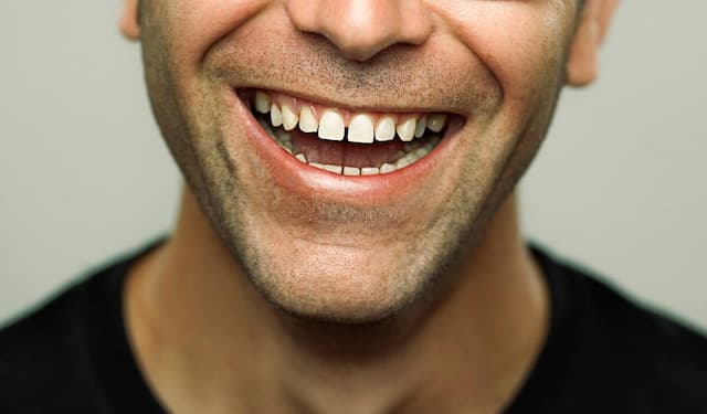 خوراکی‌های مفید و مضر برای سلامت دندان