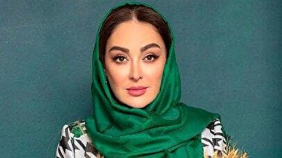 تغییر چهره جنجالی الهام حمیدی خبرساز شد! + عکس