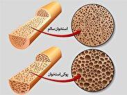 این خوراکی کوچک، دشمن بزرگ پوکی استخوان است