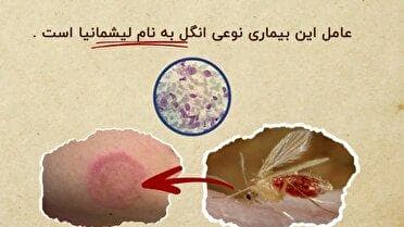 کاهش ۹۵ درصدی بیماری سالک در نطنز