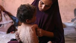 شهادت ۲۲۲ نفر در غزه به‌دلیل گرسنگی و سوءتغذیه