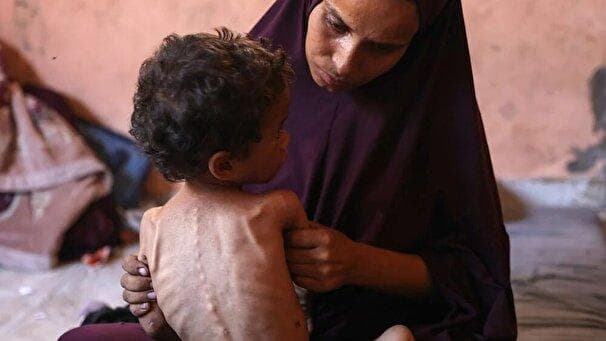 شهادت ۲۲۲ نفر در غزه به‌دلیل گرسنگی و سوءتغذیه