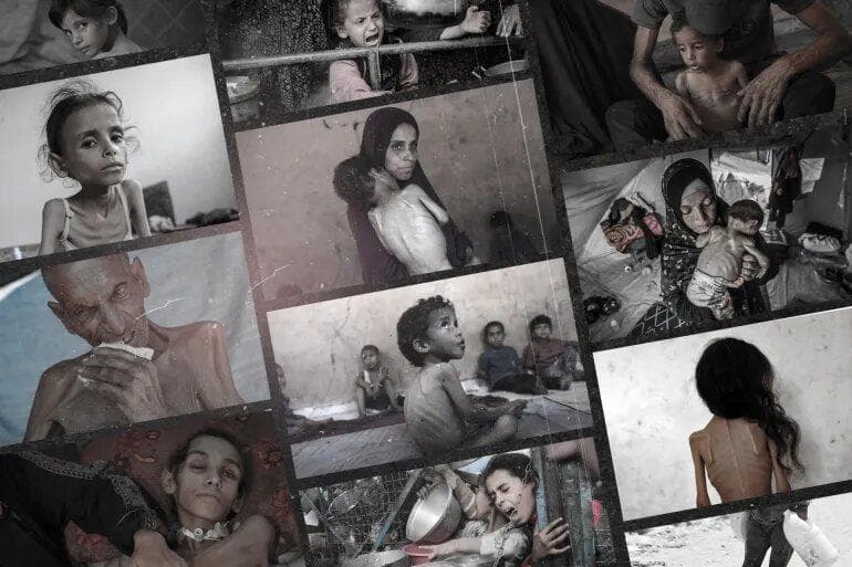 بازتاب قحطی غزه در رسانه‌های غربی؛ مردمی که به جای غذا، علف می‌خورند