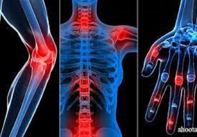 سلول‌های بنیادی بندناف به کمک بیماران مبتلا به آرتروز آمد
