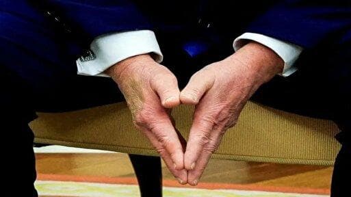 «ترامپ» جلوی دوربین آمد، اما افکار عمومی هنوز می‌گویند او بیمار است؛ چرا؟ / ترامپ؛ از پیش‌بینی عمر ۲۰۰ ساله تا یک کبودی روی دست که همه چیز را به هم ریخت