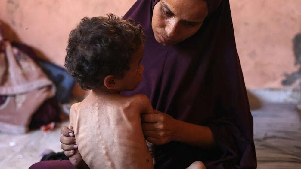 شهادت ۲۲۲نفر در غزه به دلیل گرسنگی و سوتغذیه