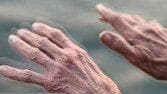 روند پیشروی پارکینسون چگونه کند می‌شود؟
