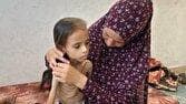 یونیسف: ۱۳ هزار کودک در غزه از سوء تغذیه شدید رنج می‌برند