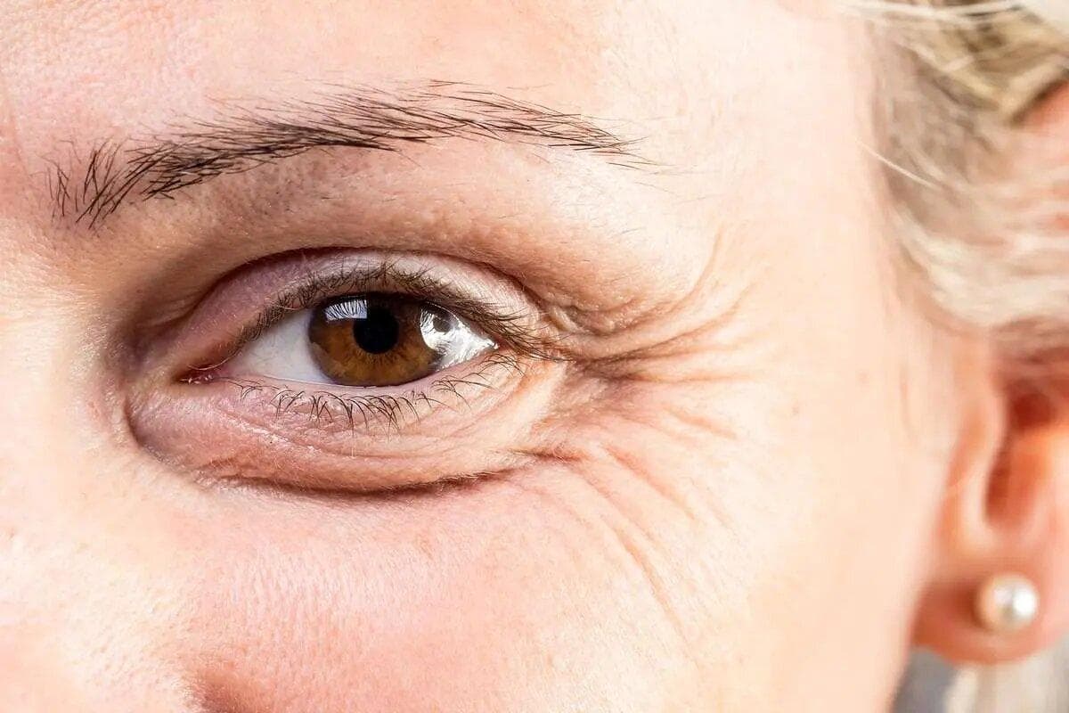 آیا می‌دانید چرا با بالا رفتن سن پوستمان چروک می‌شود؟
