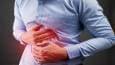 علائم و دلایل رفلاکس معده از زبان متخصص