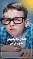 اصلاح نزدیک‌بینی بدون جراحی