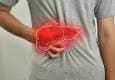 ۳ گام اشتباه در مسیر سیروز کبدی | چه کنیم کبد چرب نگیریم؟
