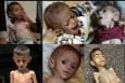 یک میلیون کودک غزه دچار شوک‌های روانی و سوءتغذیه هستند