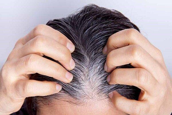یافتهای جدید درباره سفید شدن مو