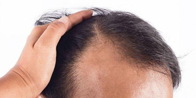 سرم معجزهآسا: رشد مو تنها در ۲۰ روز ممکن شد