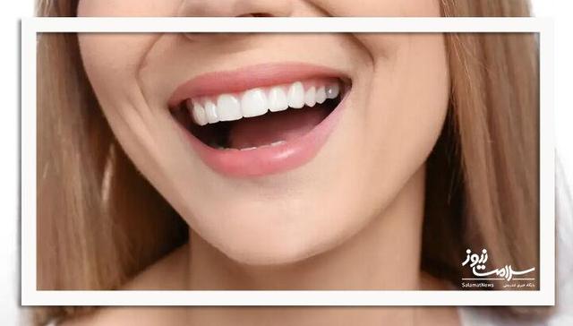 ژل نوآورانهای که مینای دندان را ظرف چند هفته بازسازی میکند