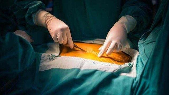 استانداردهای جهانی در جراحی چاقی ایران