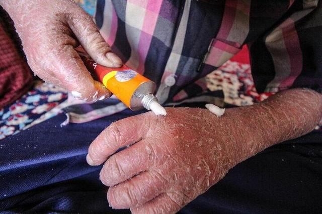 لزوم شفافیت بودجهای انجمنهای حمایت از بیماران