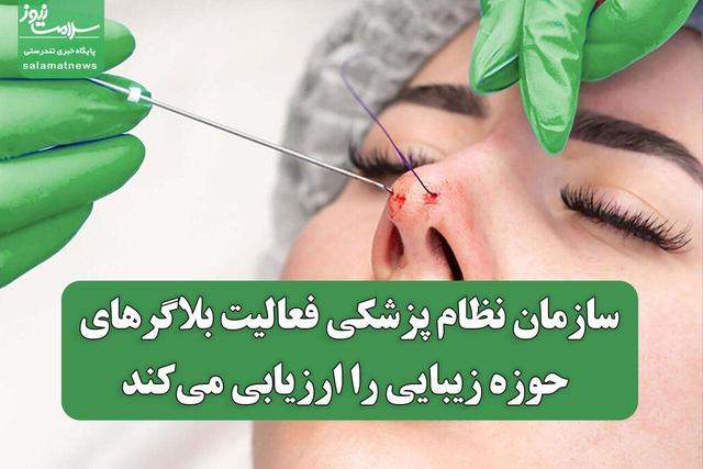 سازمان نظام پزشکی فعالیت بلاگرهای حوزه زیبایی را ارزیابی میکند