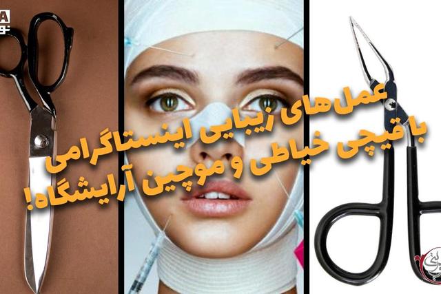 دوفوریتی | عملهای زیباییی اینستاگرامی با قیچی خیاطی و موچین آرایشگاه!