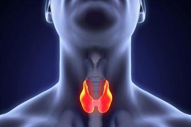درمان سرطان تیروئید: از تشخیص زودهنگام تا رویکردهای کمتهاجمی نوین