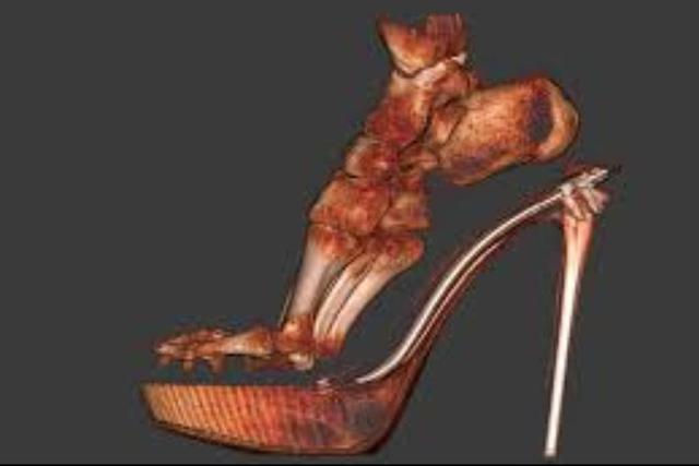 پاشنهبلند؛ زیبایی پرهزینهای که شکل پا را تغییر میدهد