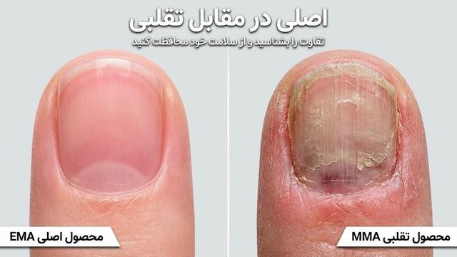 عوارض خاموش و هولناک مواد تقلبی کاشت ناخن؛ هشدار جدی به بانوان و ناخنکاران