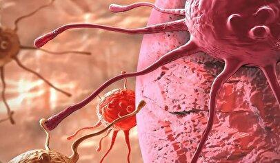 علائم هشداردهنده سرطان بشناسید/ این نشانهها را بهموقع پیگیری کنید